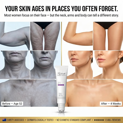 WARNING: Only 3 Units Left — The #1 Collagen Roller Cream for Sagging Skin on Neck, Arms, Thighs & Full Body | 4-Week Results
